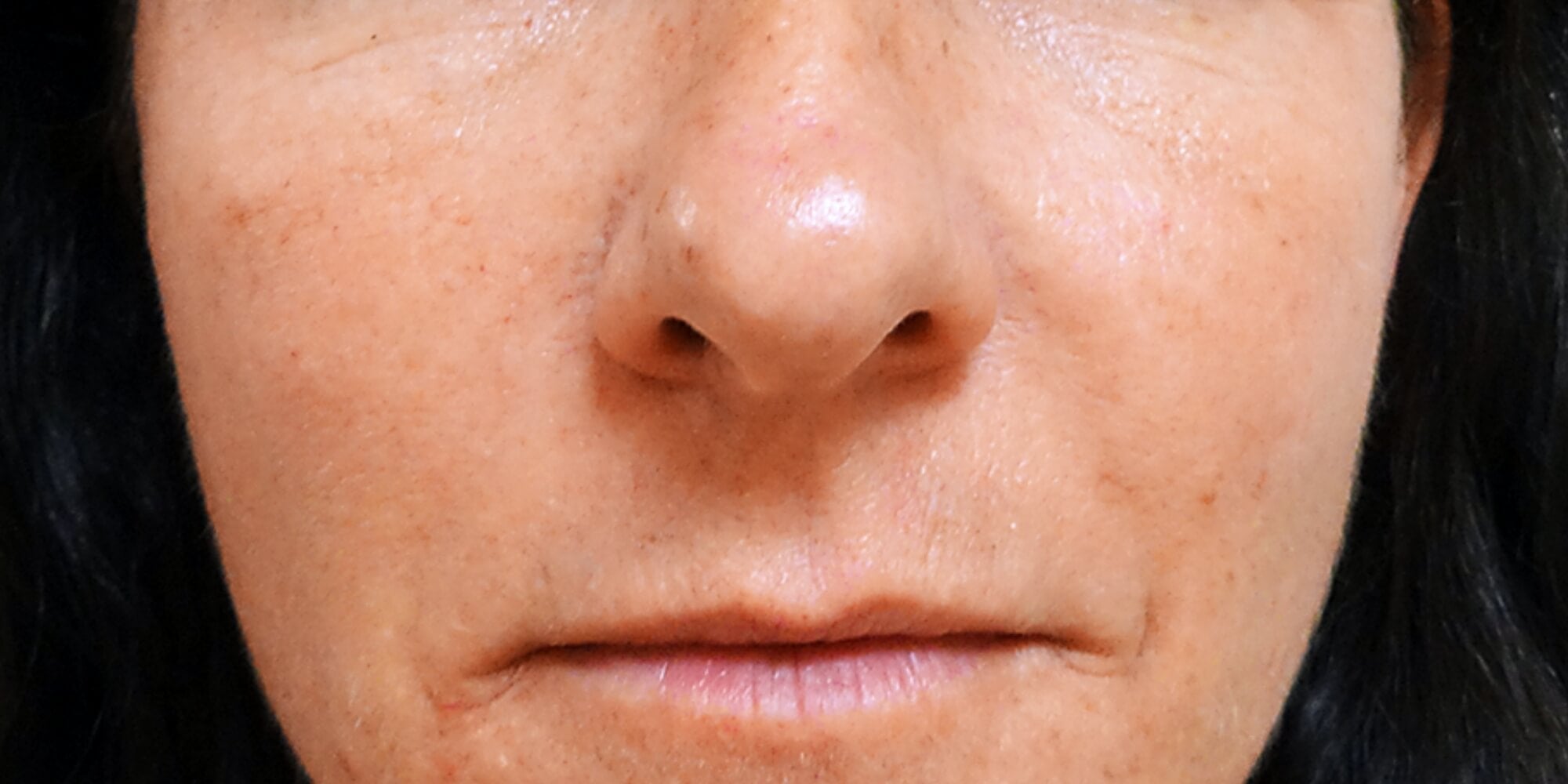 Woman's face after using aging gracefully routine