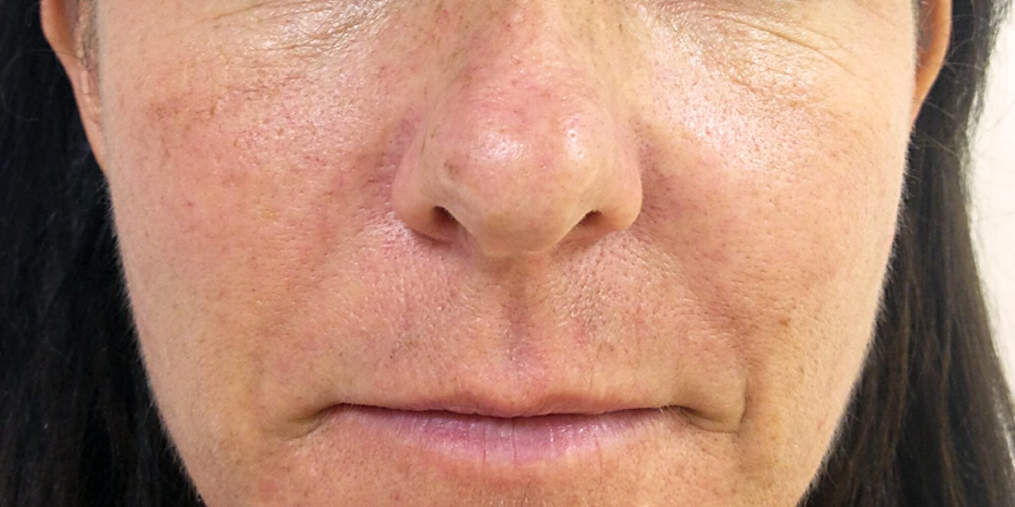 woman's skin before using aging gracefully routine